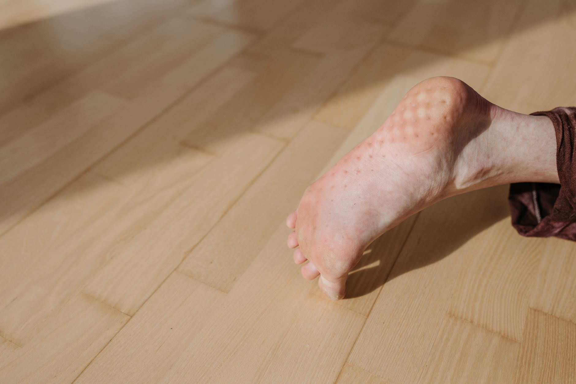 Njega i sanacija ispucalih peta u pedikerskom salonu